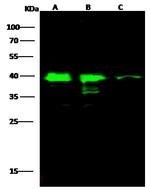 SAE1 Polyclonal Antibody