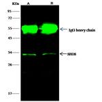 SBDS Antibody in Immunoprecipitation (IP)