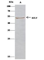 SCLY Antibody in Immunoprecipitation (IP)