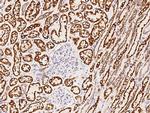 SDHA Antibody in Immunohistochemistry (Paraffin) (IHC (P))