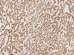 SDHA Antibody in Immunohistochemistry (Paraffin) (IHC (P))
