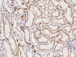 SDHB Antibody in Immunohistochemistry (Paraffin) (IHC (P))