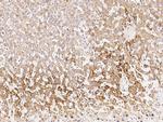 SDHB Antibody in Immunohistochemistry (Paraffin) (IHC (P))