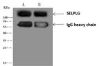 CD162 Antibody in Immunoprecipitation (IP)