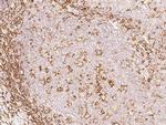 CD162 Antibody in Immunohistochemistry (Paraffin) (IHC (P))