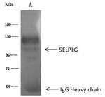 CD162 Antibody in Immunoprecipitation (IP)