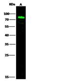 CD100 Antibody in Western Blot (WB)
