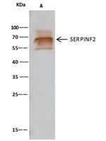 SERPINF2 Antibody in Immunoprecipitation (IP)