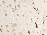 Neuroserpin Polyclonal Antibody