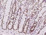 SIN3A Antibody in Immunohistochemistry (Paraffin) (IHC (P))
