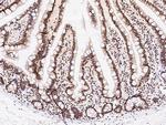SIN3A Antibody in Immunohistochemistry (Paraffin) (IHC (P))
