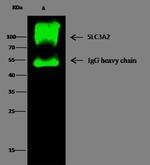 CD98 Antibody in Immunoprecipitation (IP)