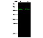 CD43 Antibody in Western Blot (WB)
