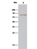 SRFBP1 Antibody in Immunoprecipitation (IP)