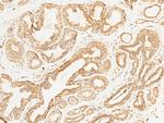 STIM1 Polyclonal Antibody