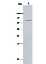 MST1 (STK4) Antibody in Immunoprecipitation (IP)