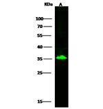 SULT2A1 Polyclonal Antibody