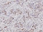 SUV39H2 Polyclonal Antibody