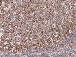 TACC3 Antibody in Immunohistochemistry (Paraffin) (IHC (P))