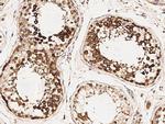 TACC3 Antibody in Immunohistochemistry (Paraffin) (IHC (P))