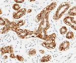 TROP2 Antibody in Immunohistochemistry (Paraffin) (IHC (P))