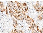 TROP2 Antibody in Immunohistochemistry (Paraffin) (IHC (P))
