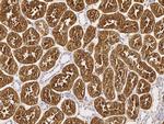 DP2 Antibody in Immunohistochemistry (Paraffin) (IHC (P))