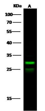 TFPI2 Polyclonal Antibody