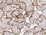 TGFBR1 Antibody in Immunohistochemistry (Paraffin) (IHC (P))