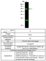 TGFBR1 Antibody in Western Blot (WB)