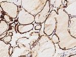 Thyroid Peroxidase Antibody in Immunohistochemistry (Paraffin) (IHC (P))