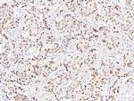 TLE1 Antibody in Immunohistochemistry (Paraffin) (IHC (P))