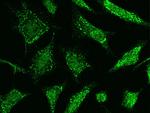 TNFAIP3 Polyclonal Antibody