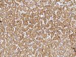 CD264 (TRAIL-R4) Antibody in Immunohistochemistry (Paraffin) (IHC (P))