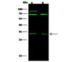 BCMA Antibody in Western Blot (WB)