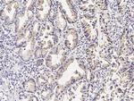 DcR3 Antibody in Immunohistochemistry (Paraffin) (IHC (P))