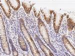 TRAIL Polyclonal Antibody