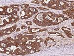 APRIL Antibody in Immunohistochemistry (Paraffin) (IHC (P))