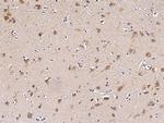 TPT1 Antibody in Immunohistochemistry (Paraffin) (IHC (P))