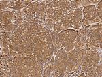 TPT1 Polyclonal Antibody