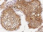 TSNAX Antibody in Immunohistochemistry (Paraffin) (IHC (P))