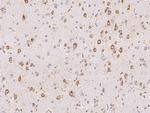 MPS1 Antibody in Immunohistochemistry (Paraffin) (IHC (P))