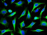 beta Tubulin Antibody in Immunocytochemistry (ICC/IF)