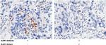 ULBP2 Polyclonal Antibody
