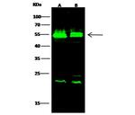 VRK1 Polyclonal Antibody