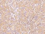 VISTA Polyclonal Antibody