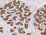 B7-H4 Antibody in Immunohistochemistry (Paraffin) (IHC (P))