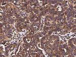 B7-H4 Antibody in Immunohistochemistry (Paraffin) (IHC (P))