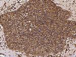 B7-H4 Antibody in Immunohistochemistry (Paraffin) (IHC (P))