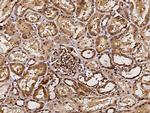 B7-H4 Antibody in Immunohistochemistry (Paraffin) (IHC (P))